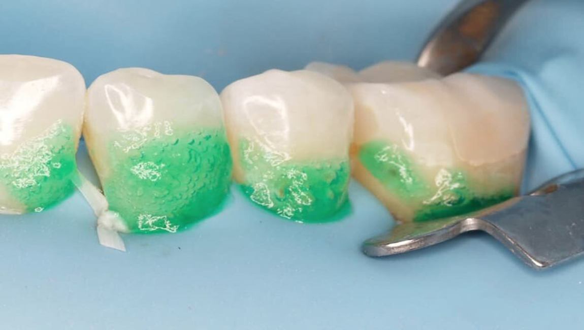 Технология ICON